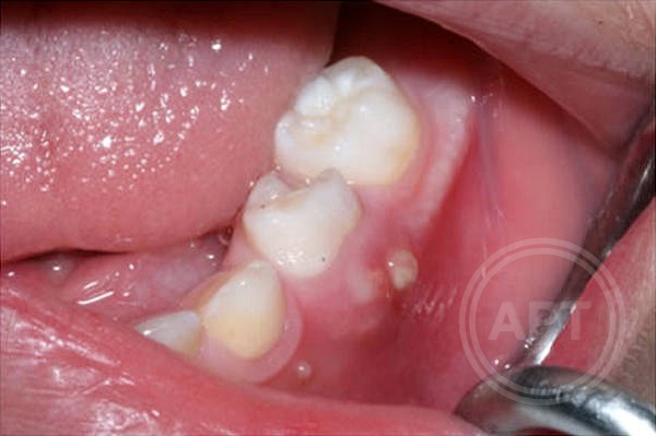 Kra21at